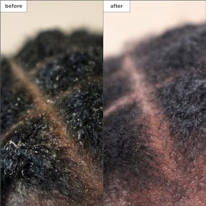 Briogeo Scalp Revival Charcoal + Tea Tree Scalp Treatment - Leave-In Serum for Dry, Flaky, or Itchy Scalp - Hydrating & Balancing - Vegan & Cruelty Free - 1 oz Avelisse