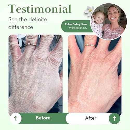 Theraplex Skin Barrier Balm - Barrier Repair Moisturizer Cream for Dry, Sensitive Skin - Hypoallergenic, Noncomedogenic - 6 oz Avelisse
