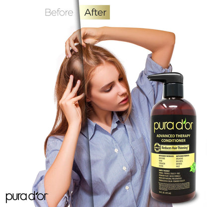 PURA D'OR Advanced Therapy Conditioner – Moisture, Strength, Volume & Texture – No Sulfates – Argan Oil & Biotin – All Hair Types – 16 oz