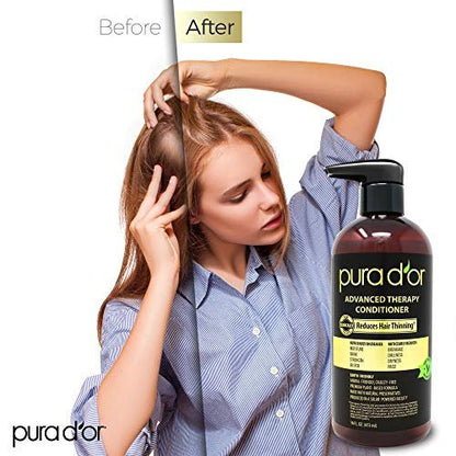 PURA D'OR Advanced Therapy Conditioner – Moisture, Strength, Volume & Texture – No Sulfates – Argan Oil & Biotin – All Hair Types – 16 oz