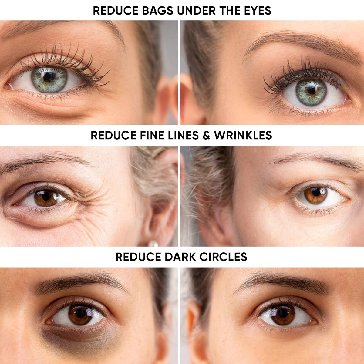 Instant Ageless Eye Cream - Reduce Under Eye Bags, Wrinkles, Dark Circles & Fine Lines - Tighten & Lift Sagging Skin Avelisse