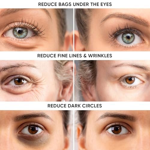 Instant Ageless Eye Cream - Reduce Under Eye Bags, Wrinkles, Dark Circles & Fine Lines - Tighten & Lift Sagging Skin Avelisse