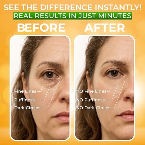 Puffy Eye Treatment – Instant Results with Green Tea Extract & Dead Sea Minerals by SEAMANTIKA – 0.8 fl oz Avelisse