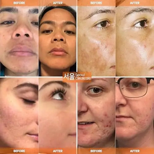SeoulCeuticals 20% Vitamin C + Hyaluronic Acid Serum with CE Ferulic Acid – Anti Aging & Brightening Korean Face Serum, 1 oz Avelisse