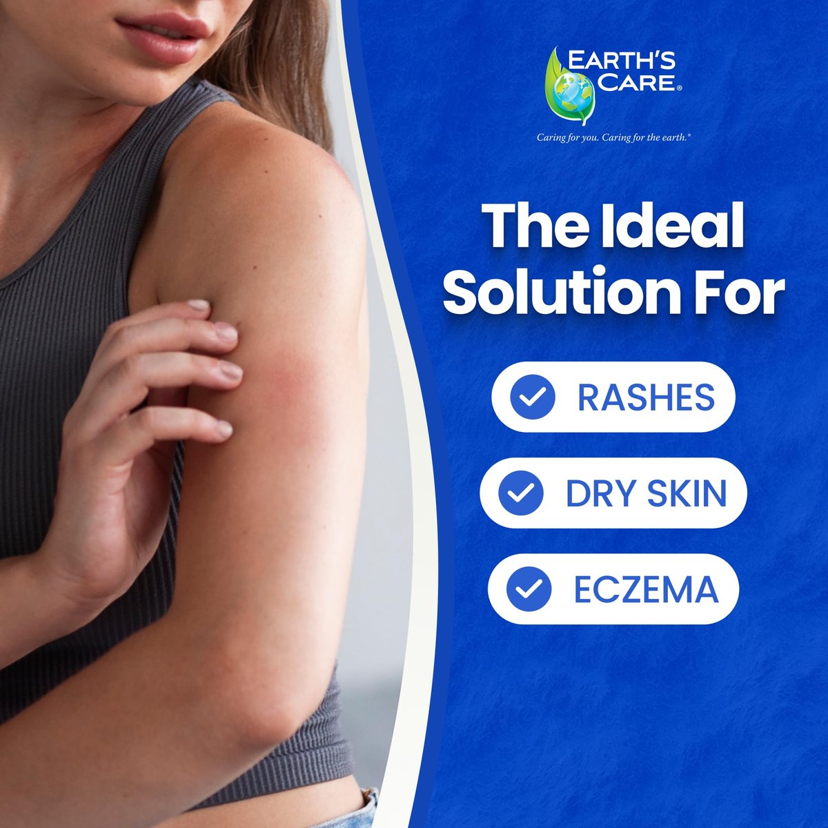 Earth's Care Eczema Lotion - Natural, Safe & Mild Lotion for Eczema for Adults and Kids - 8 Fl Oz (237 mL) - görsel 11