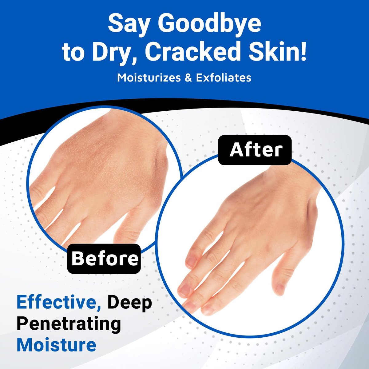 Dermal Therapy Alpha Hydroxy Lotion – 10% Urea + 10% Lactic Acid, Fragrance-Free Body Lotion for Dry, Cracked Skin, Non-Greasy Exfoliating Moisturizer & Keratosis Pilaris Treatment, 16 fl oz (474 ml) Avelisse