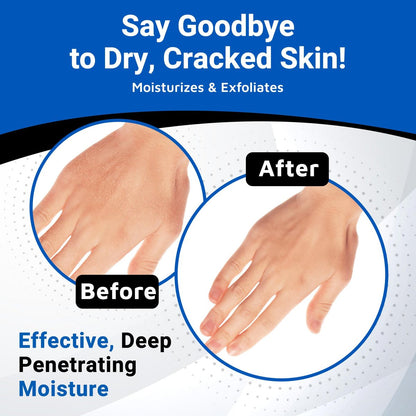 Dermal Therapy Alpha Hydroxy Lotion – 10% Urea + 10% Lactic Acid, Fragrance-Free Body Lotion for Dry, Cracked Skin, Non-Greasy Exfoliating Moisturizer & Keratosis Pilaris Treatment, 16 fl oz (474 ml) Avelisse