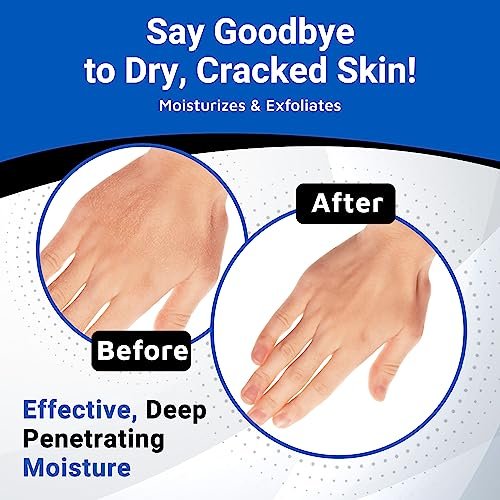 Dermal Therapy Alpha Hydroxy Lotion – 10% Urea + 10% Lactic Acid, Fragrance-Free Body Lotion for Dry, Cracked Skin, Non-Greasy Exfoliating Moisturizer & Keratosis Pilaris Treatment, 16 fl oz (474 ml) Avelisse
