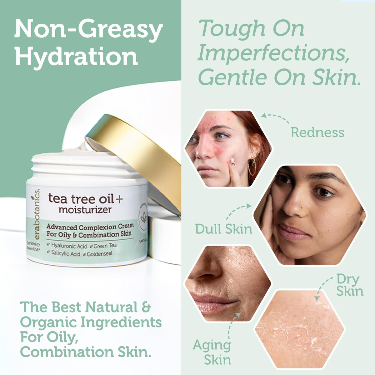 Era Organics Tea Tree Moisturizer Cream for Oily & Acne Prone Skin - Non-Greasy Face Cream with Salicylic Acid, Green Tea & Zinc - 2 oz Avelisse