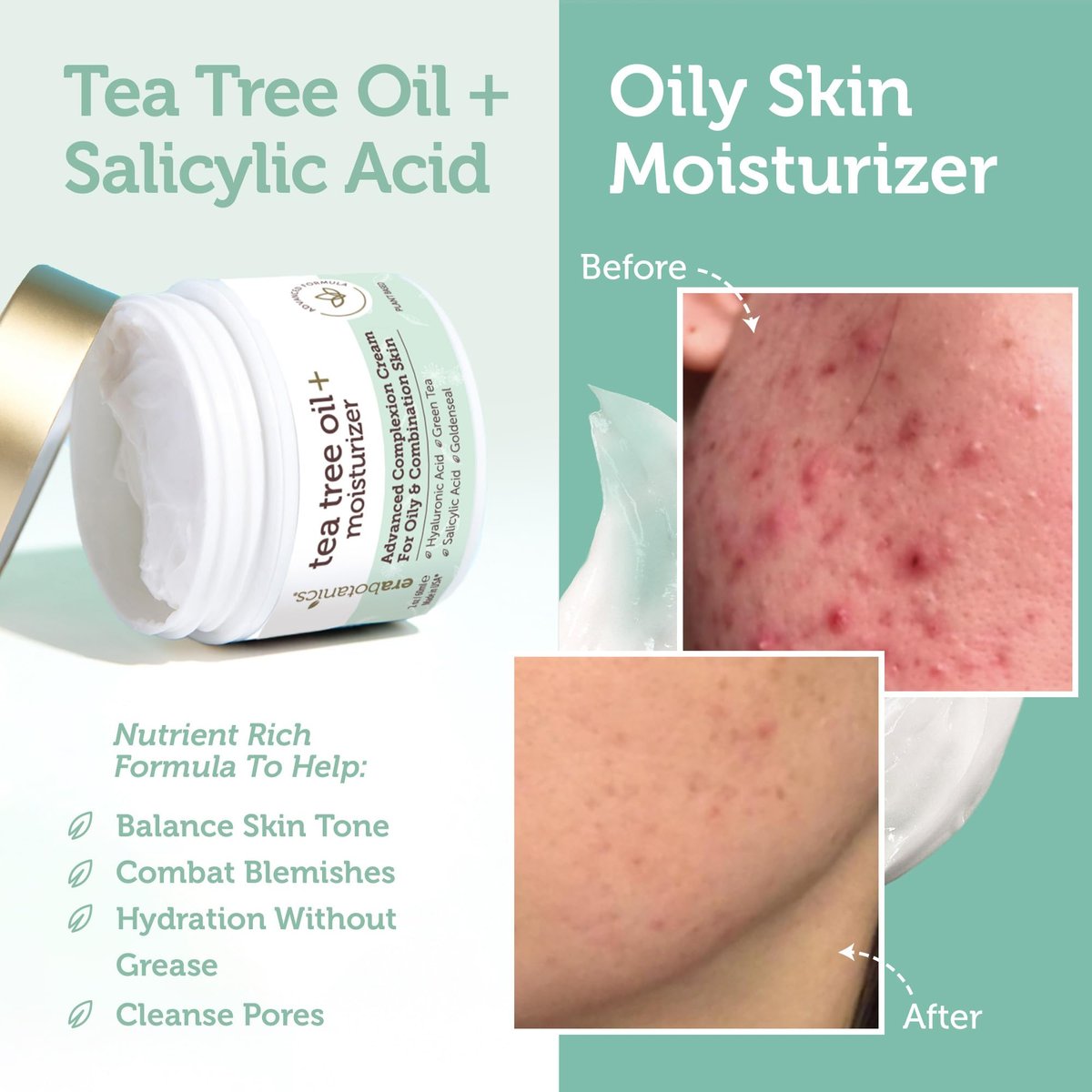 Era Organics Tea Tree Moisturizer Cream for Oily & Acne Prone Skin - Non-Greasy Face Cream with Salicylic Acid, Green Tea & Zinc - 2 oz Avelisse