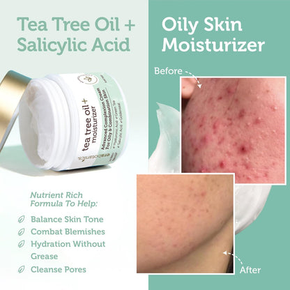 Era Organics Tea Tree Moisturizer Cream for Oily & Acne Prone Skin - Non-Greasy Face Cream with Salicylic Acid, Green Tea & Zinc - 2 oz Avelisse
