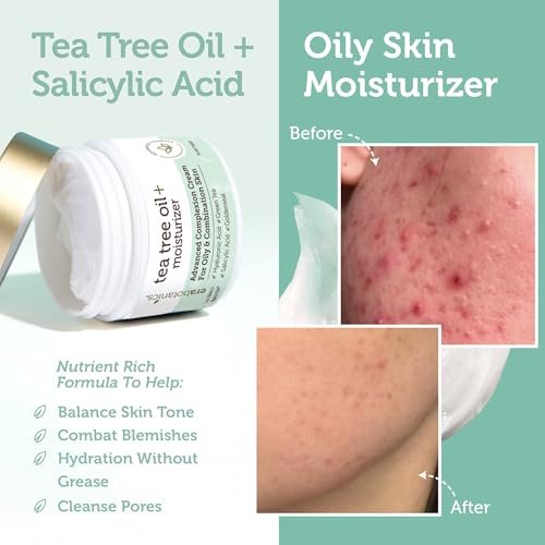 Era Organics Tea Tree Moisturizer Cream for Oily & Acne Prone Skin - Non-Greasy Face Cream with Salicylic Acid, Green Tea & Zinc - 2 oz Avelisse