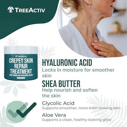 TreeActiv Crepey Skin Repair Cream – Firming Body & Neck Cream with Hyaluronic Acid, Glycolic Acid & Shea Butter, 8 oz Avelisse