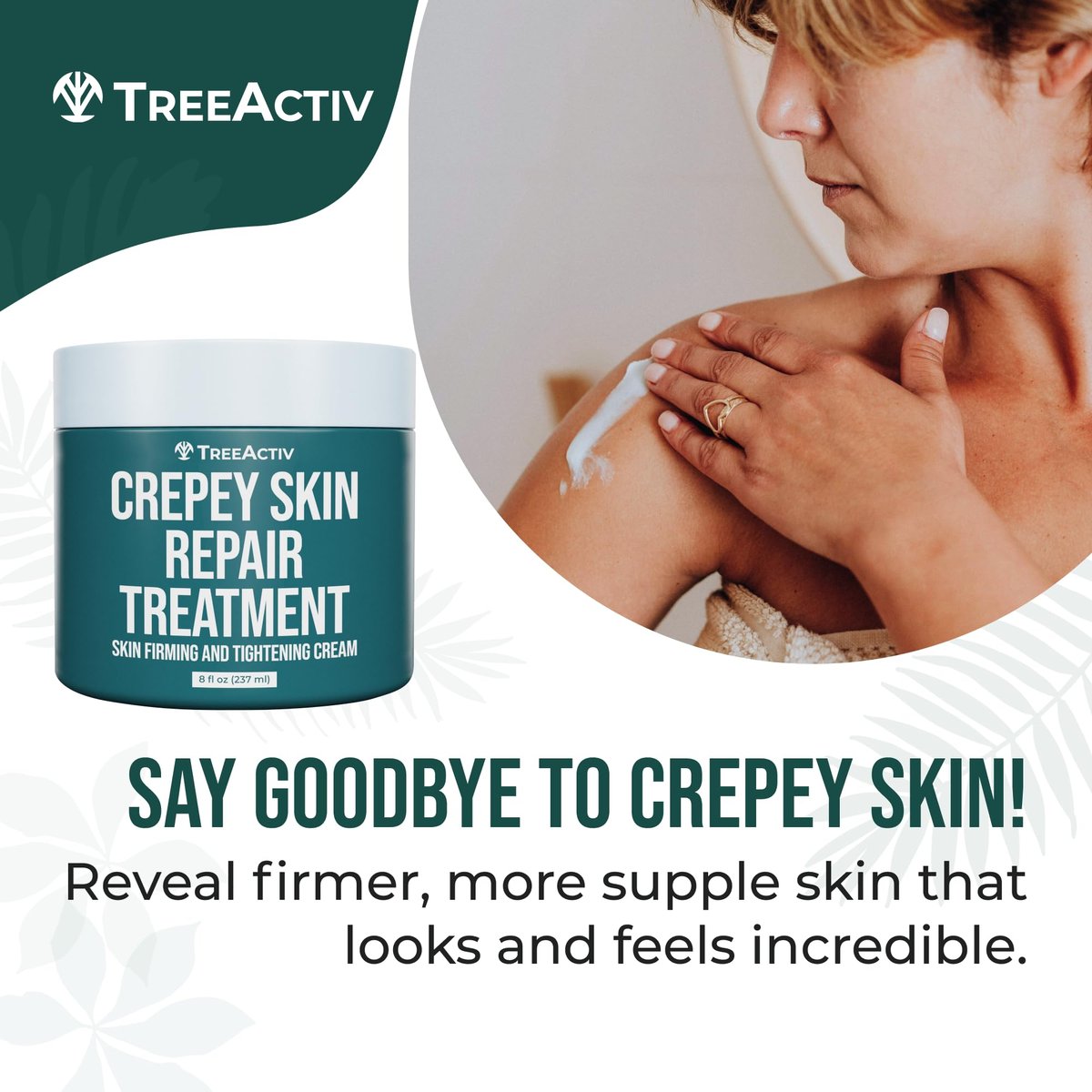 TreeActiv Crepey Skin Repair Cream – Firming Body & Neck Cream with Hyaluronic Acid, Glycolic Acid & Shea Butter, 8 oz Avelisse