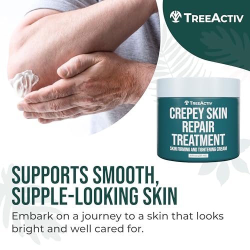 TreeActiv Crepey Skin Repair Cream – Firming Body & Neck Cream with Hyaluronic Acid, Glycolic Acid & Shea Butter, 8 oz Avelisse