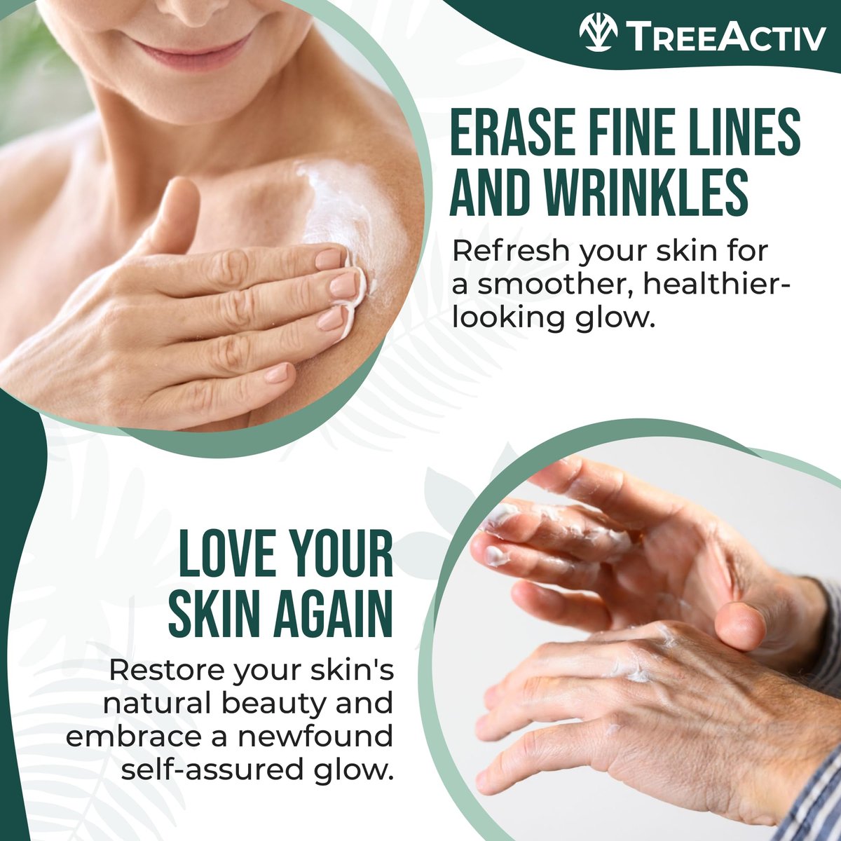 TreeActiv Crepey Skin Repair Cream – Firming Body & Neck Cream with Hyaluronic Acid, Glycolic Acid & Shea Butter, 8 oz Avelisse