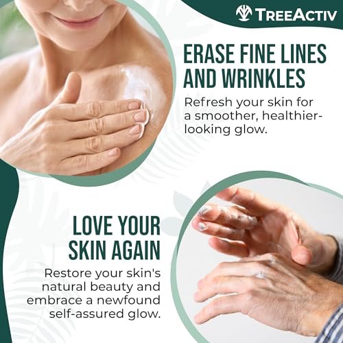 TreeActiv Crepey Skin Repair Cream – Firming Body & Neck Cream with Hyaluronic Acid, Glycolic Acid & Shea Butter, 8 oz Avelisse