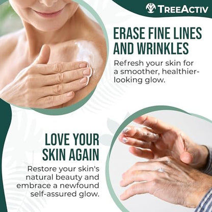 TreeActiv Crepey Skin Repair Cream – Firming Body & Neck Cream with Hyaluronic Acid, Glycolic Acid & Shea Butter, 8 oz Avelisse