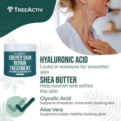 TreeActiv Crepey Skin Repair Cream – Firming Body & Neck Cream with Hyaluronic Acid, Glycolic Acid & Shea Butter, 8 oz Avelisse