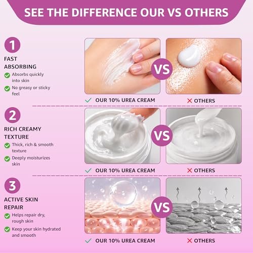 UREA LABS 10% Urea Cream with Aloe Vera, Jojoba Oil and Salicylic Acid - 150ml Hydrating Moisturizer for Dry, Chapped Hands, Feet, Face & Body - Repairs, Soothes & Nourishes Rough, Dry Skin - 4 Oz Avelisse