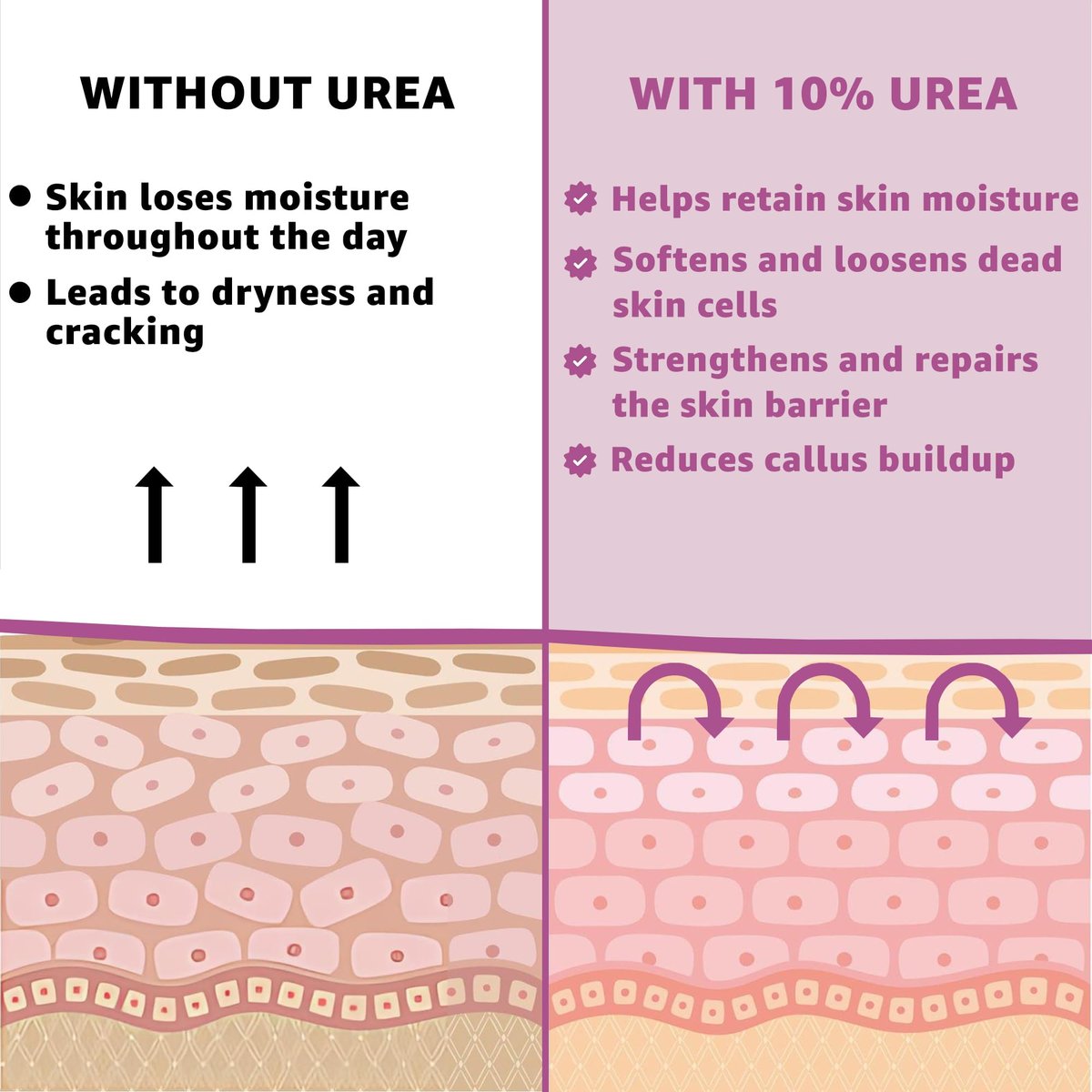 UREA LABS 10% Urea Cream with Aloe Vera, Jojoba Oil and Salicylic Acid - 150ml Hydrating Moisturizer for Dry, Chapped Hands, Feet, Face & Body - Repairs, Soothes & Nourishes Rough, Dry Skin - 4 Oz Avelisse