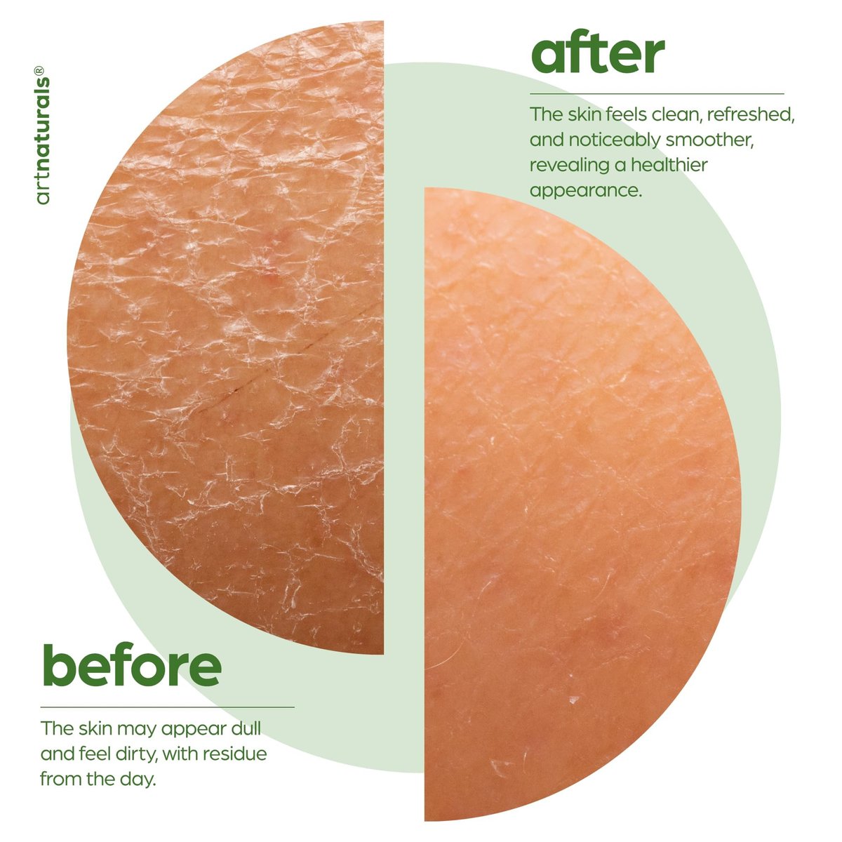 Artnaturals Tea Tree Body Wash - 12 oz | Natural Cleansing & Refreshing Shower Gel Avelisse