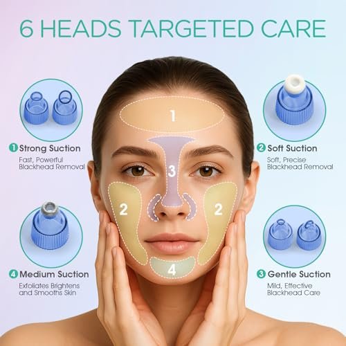 VOYOR Blackhead Remover Pore Vacuum - Electric Face Vacuum Pore Cleaner for Acne and White Heads Removal with 6 Suction Heads (BR410) Avelisse