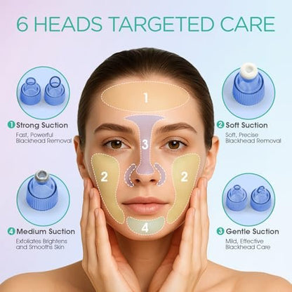VOYOR Blackhead Remover Pore Vacuum - Electric Face Vacuum Pore Cleaner for Acne and White Heads Removal with 6 Suction Heads (BR410) Avelisse