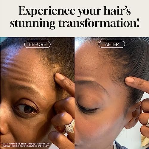 Biotin Hair Growth Serum – Advanced Topical Formula for Healthy, Strong Hair | Pureauty Naturals (2 Fl Oz) Avelisse