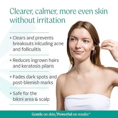 Almond Clear Face & Body Clearing Serum Level 1 – Mandelic Acid for Acne, Folliculitis, Ingrown Hairs, Dark Spots – 1 fl oz Avelisse