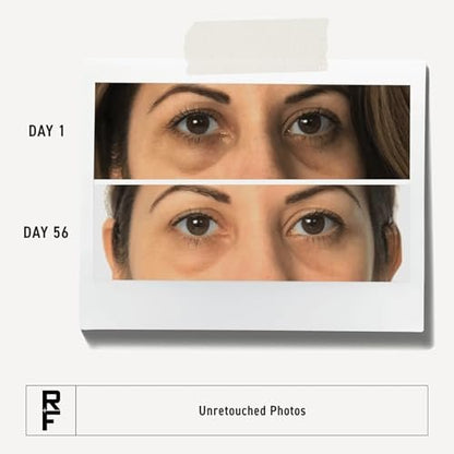 RODAN + FIELDS Active Hydration Bright Eye Complex – Moisturizing Under Eye Cream for Dry Skin, 0.51 Fl Oz Avelisse