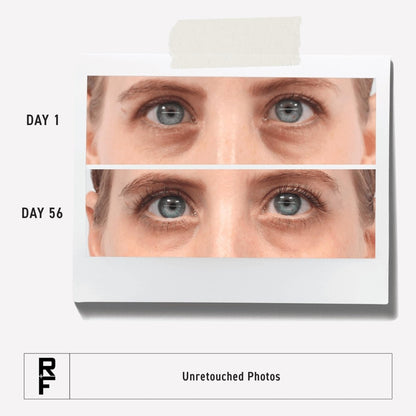 RODAN + FIELDS Active Hydration Bright Eye Complex – Moisturizing Under Eye Cream for Dry Skin, 0.51 Fl Oz Avelisse
