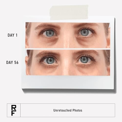 RODAN + FIELDS Active Hydration Bright Eye Complex – Moisturizing Under Eye Cream for Dry Skin, 0.51 Fl Oz Avelisse