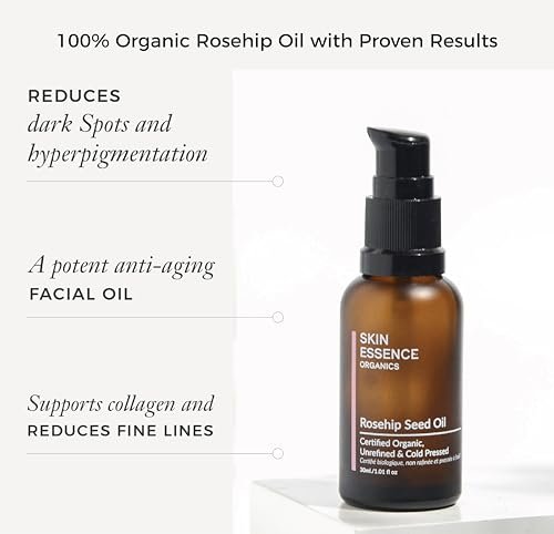 Skin Essence Organics Rosehip Seed Oil - Authentic, Cold-Pressed, & Certified Organic (30ml) - görsel 4
