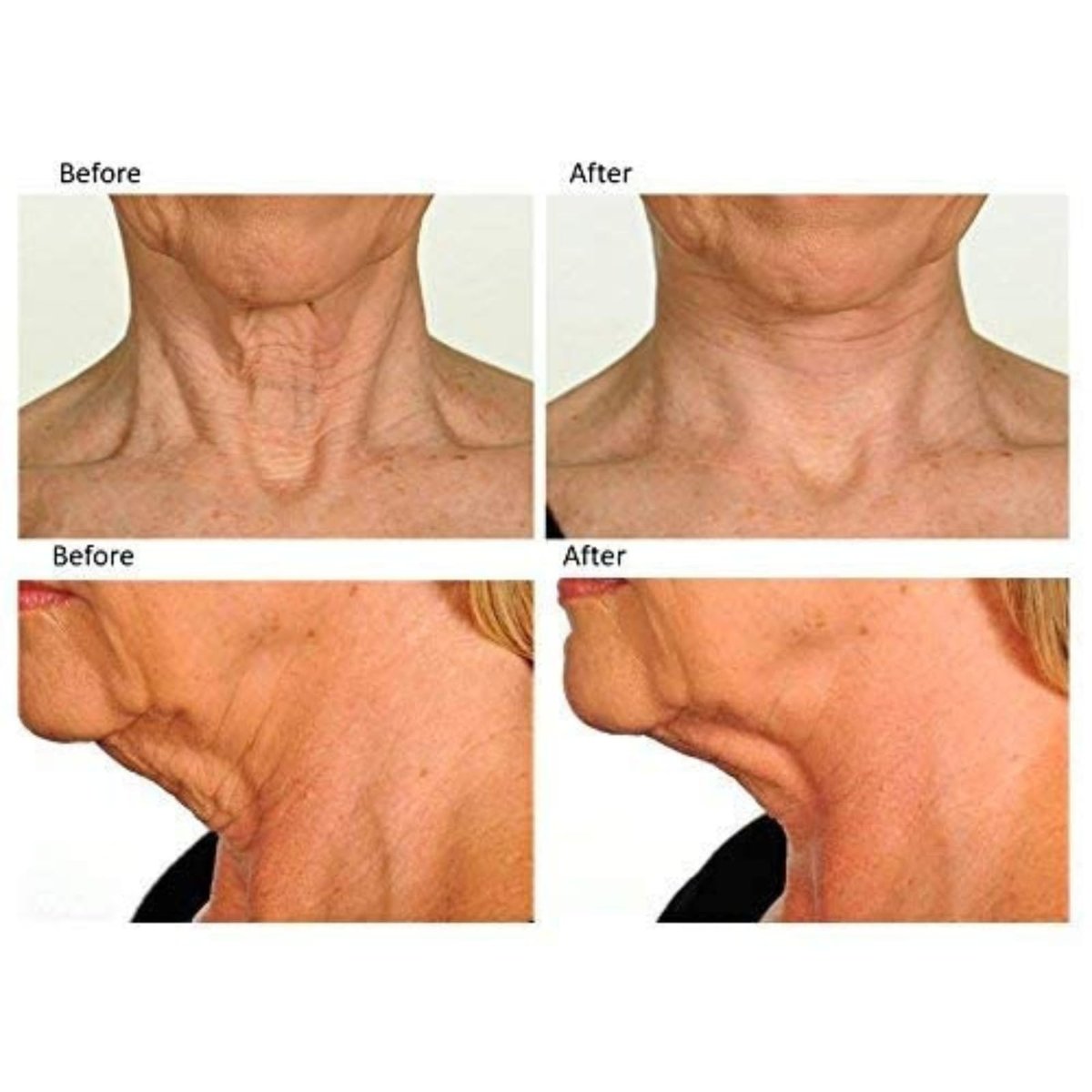 Contours Rx Neck Tightening Tape – 30 Count, Moisturizing Invisible Strips for Neck & Décolleté Avelisse