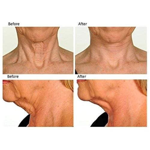Contours Rx Neck Tightening Tape – 30 Count, Moisturizing Invisible Strips for Neck & Décolleté Avelisse