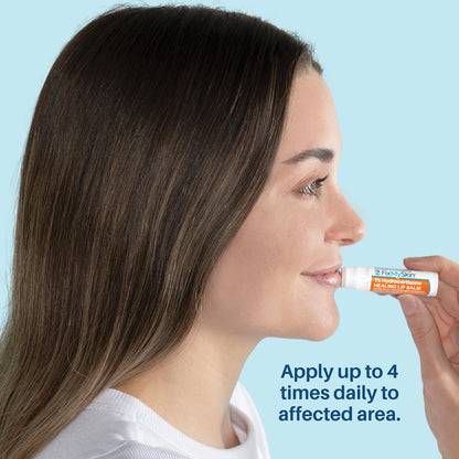 FixMySkin 1% Hydrocortisone Healing Lip Balm, Vanilla – Soothes Dry, Cracked & Irritated Lips, Relieves Chapped Lips, Cold Sores & Eczema, Dermatologist Developed, Travel-Friendly Tube, 0.15 oz Avelisse