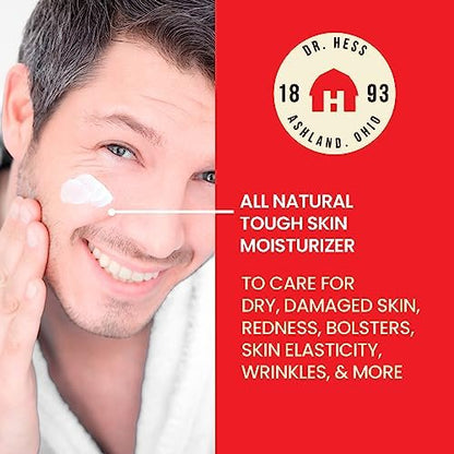 Dr Hess Men's Moisturizer - All Natural Tough Skin Cream with Lanolin, Beeswax, Licorice Root & Chamomile, Hand & Body Lotion for Dry, Damaged Skin, Paraben, Sulfate, BPA & Phthalate Free, 4oz