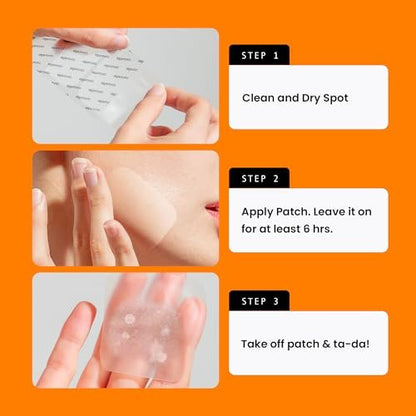 AVARELLE Acne Patches XL - Large Hydrocolloid Pimple Patches with Tea Tree, Calendula & Cica for Face, Cheek & Nose - 8 Count