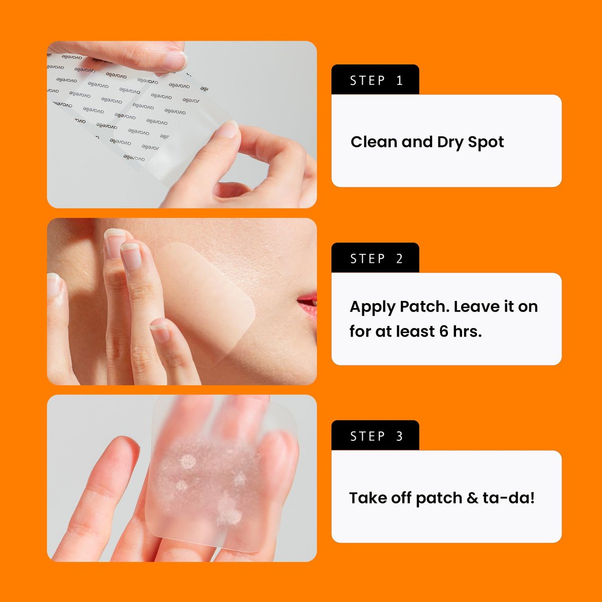 AVARELLE Acne Patches XL - Large Hydrocolloid Pimple Patches with Tea Tree, Calendula & Cica for Face, Cheek & Nose - 8 Count - görsel 13