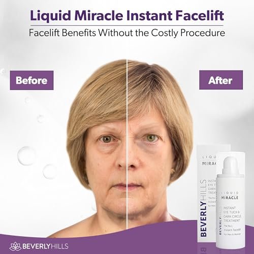 Beverly Hills Instant Facelift Anti Aging Eye Serum – 30mL (120 Days Supply) for Dark Circles, Puffy Eyes, and Wrinkles Avelisse