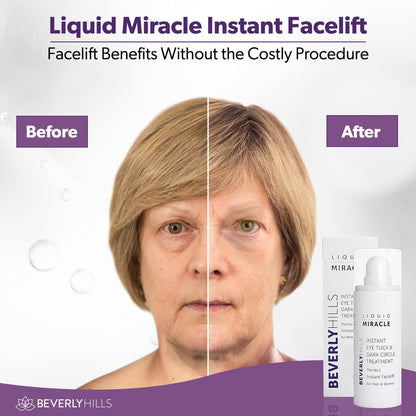 Beverly Hills Instant Facelift Anti Aging Eye Serum – 30mL (120 Days Supply) for Dark Circles, Puffy Eyes, and Wrinkles Avelisse