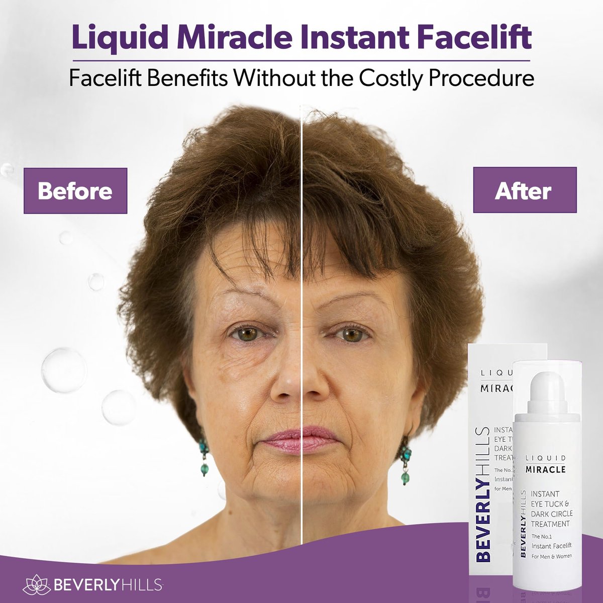 Beverly Hills Instant Facelift Anti Aging Eye Serum – 30mL (120 Days Supply) for Dark Circles, Puffy Eyes, and Wrinkles Avelisse