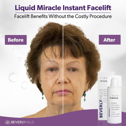 Beverly Hills Instant Facelift Anti Aging Eye Serum – 30mL (120 Days Supply) for Dark Circles, Puffy Eyes, and Wrinkles Avelisse
