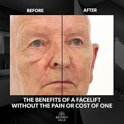Beverly Hills Men's Instant Facelift & Eye Serum – Dark Circles, Puffy Eyes, Wrinkles Avelisse