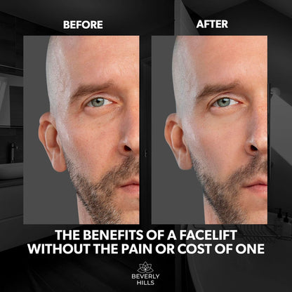 Beverly Hills Men's Instant Facelift & Eye Serum – Dark Circles, Puffy Eyes, Wrinkles Avelisse