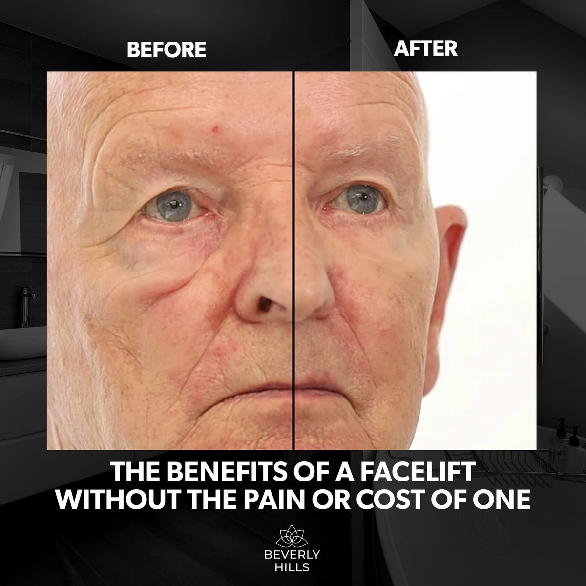 Beverly Hills Men's Instant Facelift & Eye Serum – Dark Circles, Puffy Eyes, Wrinkles Avelisse