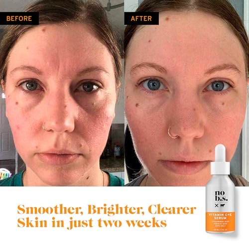 Vitamin C + E Serum - Firming Face Serum for Anti-Aging, Smooths, Hydrates, Plumps Fine Lines & Reduces Dark Spots (1 fl oz) | No Bad Stuff Avelisse