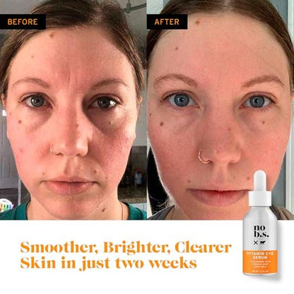 Vitamin C + E Serum - Firming Face Serum for Anti-Aging, Smooths, Hydrates, Plumps Fine Lines & Reduces Dark Spots (1 fl oz) | No Bad Stuff Avelisse