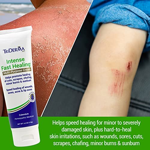 TriDerma Intense Fast Skin Healing Cream – 4 oz Tube for Hard-to-Heal Skin Irritations, Sores, Rashes, Dry Cracked Hands, Cuts, Chafing, Burns, Scrapes – FSA Eligible First Aid Essential Avelisse